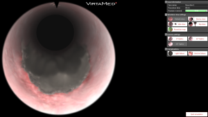Resection 1 finished