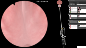 TURP Easy 3 device view